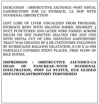 Endoscopic ultrasound guided hepaticogastrostomy (EUS HGS) Image 5