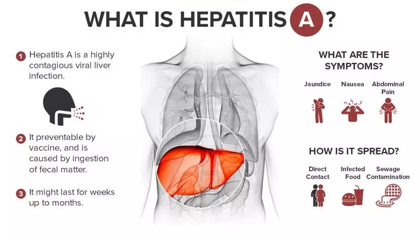 Conquering Hepatitis A: Comprehensive Care and Prevention at Noble Gastro & Liver Hospital, Ahmedabad