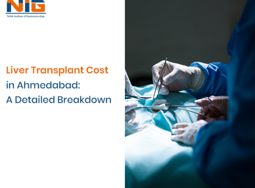 Liver Transplant Cost in Ahmedabad