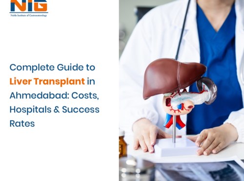 Liver Transplant in Ahmedabad