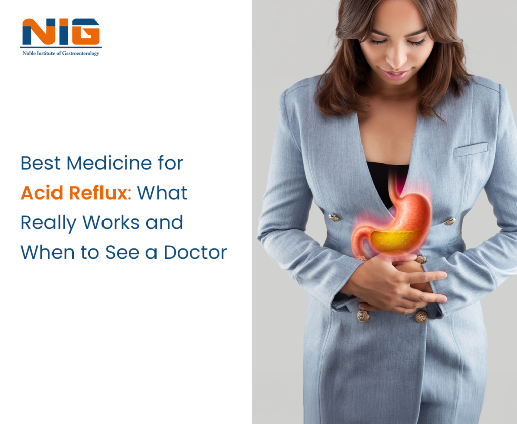 Best Medicine for Acid Reflux