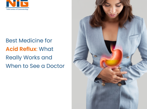 Best Medicine for Acid Reflux