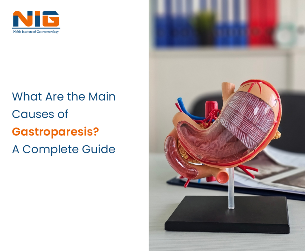 Main Causes of Gastroparesis