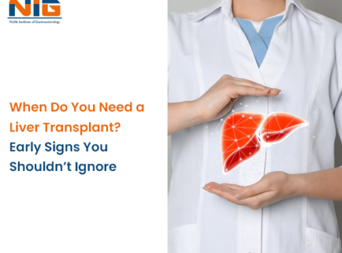 Do You Need a Liver Transplant