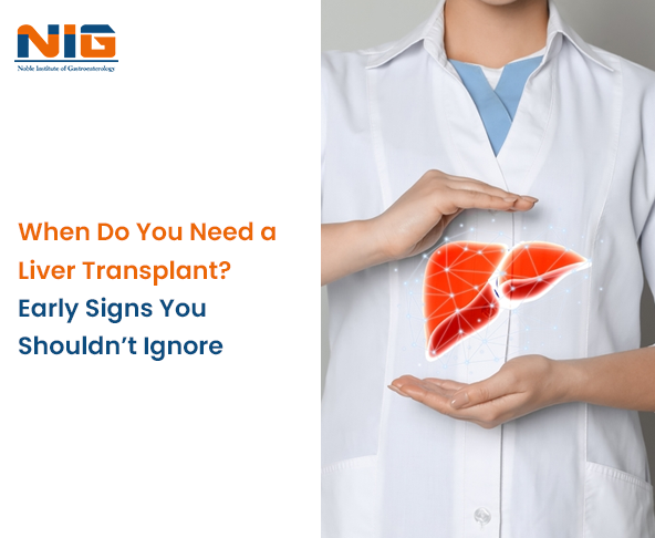 Do You Need a Liver Transplant