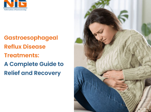 Gastroesophageal Reflux Disease Treatments