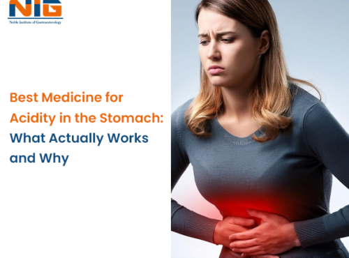 Medicine for Acidity in the Stomach
