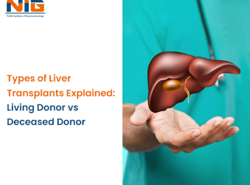 Types of Liver Transplants