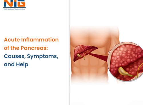 Acute Inflammation of the Pancreas