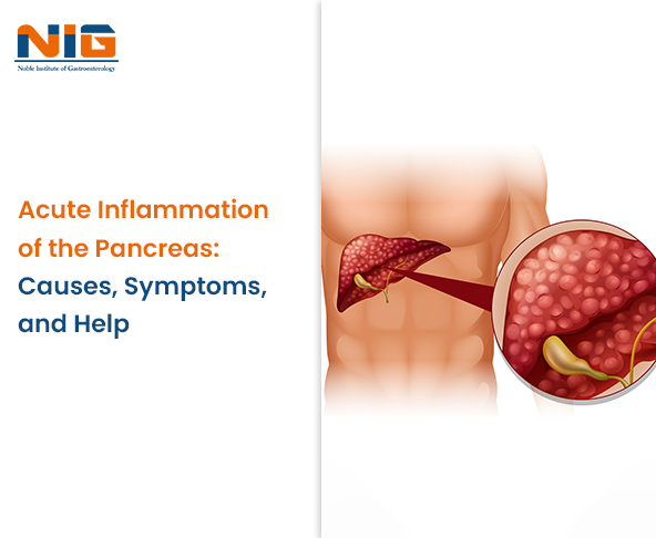 Acute Inflammation of the Pancreas