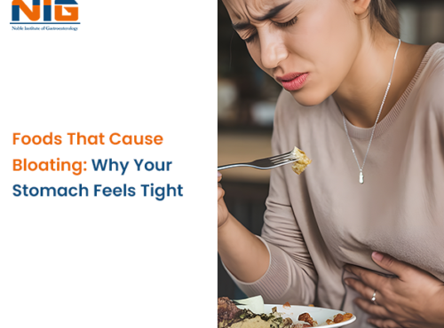 Foods That Cause Bloating