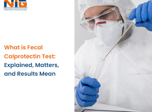 fecal calprotectin test