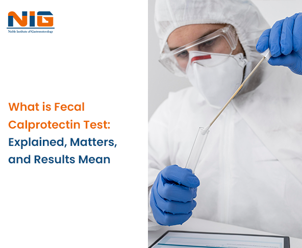 What is Fecal Calprotectin Test: Explained, Matters, and Results Mean