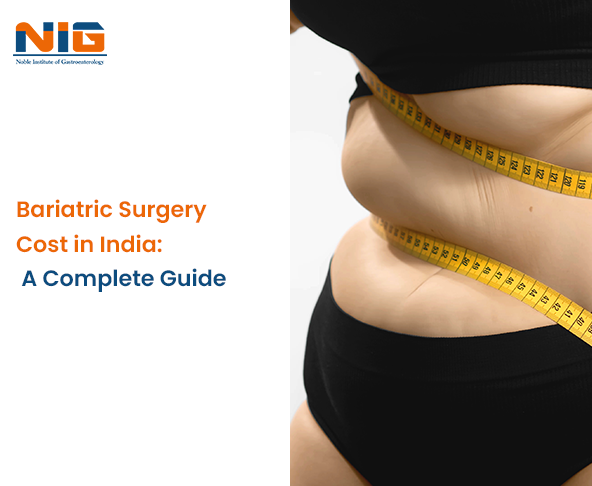 Bariatric Surgery Cost in India: A Complete Guide