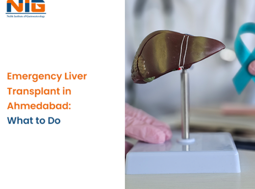 Emergency Liver Transplant in Ahmedabad