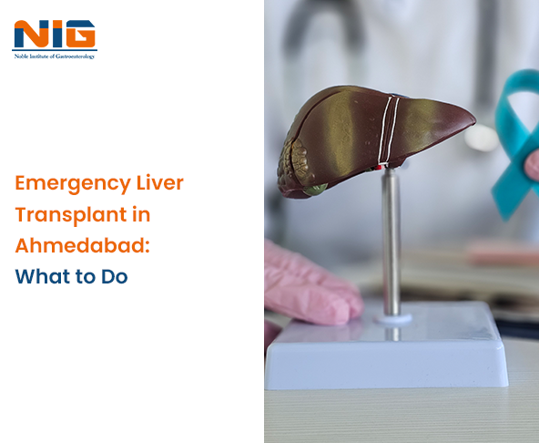 Emergency Liver Transplant in Ahmedabad