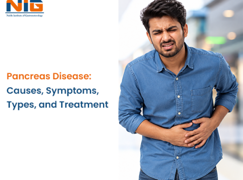 Pancreas Disease Causes, Symptoms Types, and Treatment