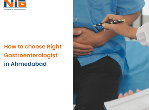 Choose the Right Gastroenterologist in Ahmedabad