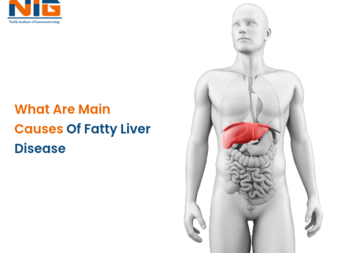 Causes of Fatty Liver Disease