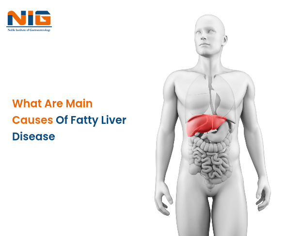 What Are the Main Causes of Fatty Liver Disease?